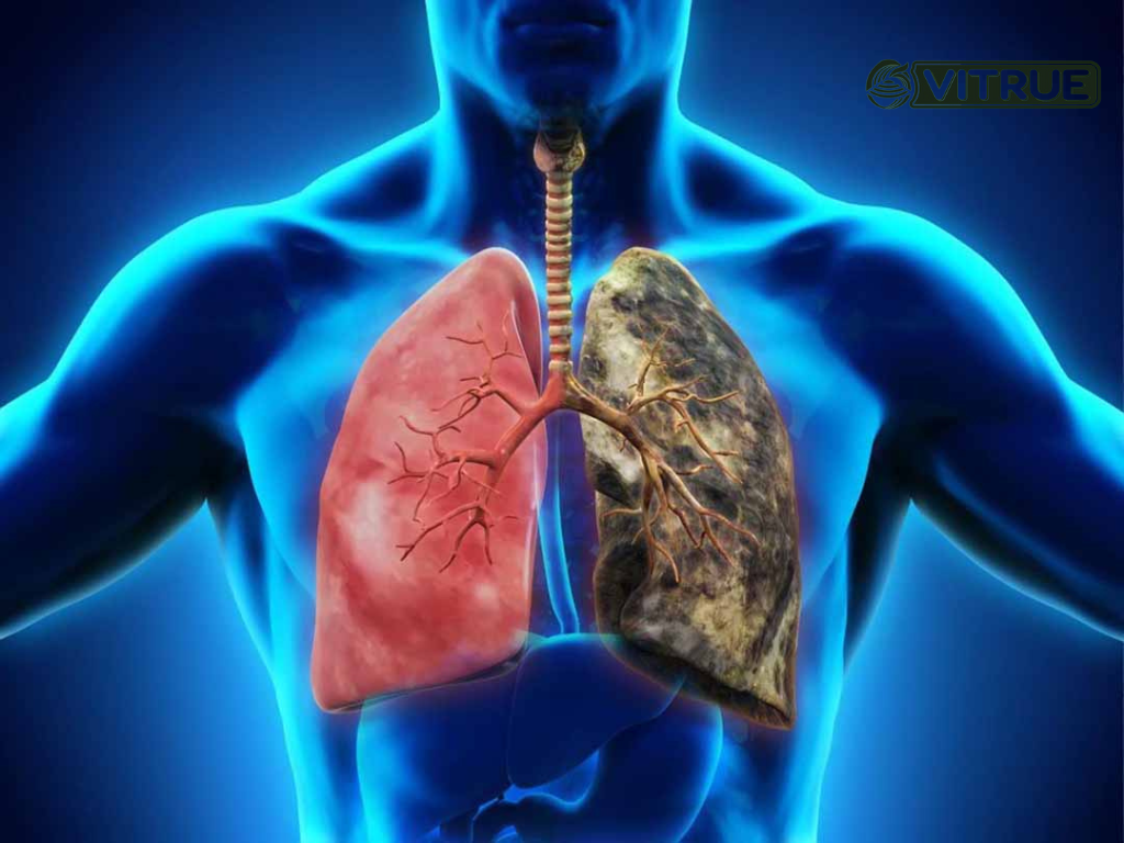 Tại sao cần detox thanh lọc giải độc phổi
