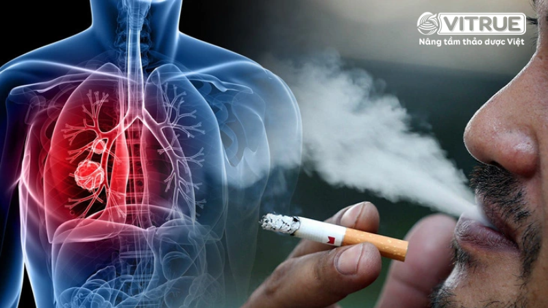 Các triệu chứng khi bị ung thư phổi giai đoạn cuối 1