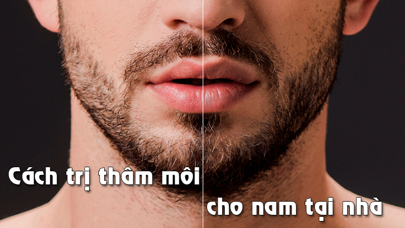 8 cách trị thâm môi cho nam tại nhà hiệu quả nhanh chóng