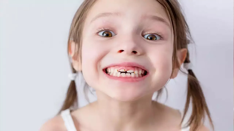 Dấu hiệu nhận biết sâu răng trẻ em sớm và cách ngừa sâu răng