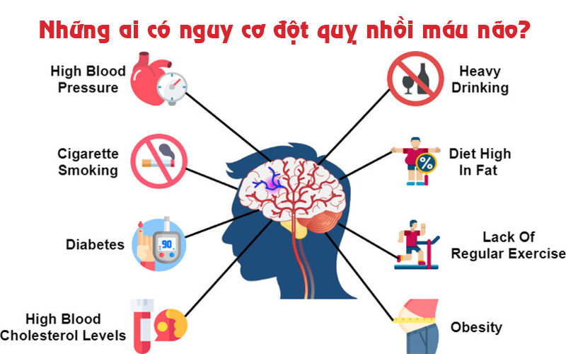 đột quỵ nhồi máu não 4